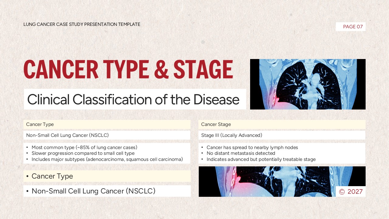 Lung Cancer Case Study Template - cancer classification slide with staging information and medical scans