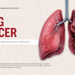Lung Cancer Case Study Template - title slide with anatomical lung illustration and professional design