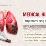 Lung Cancer Case Study Template - medical history slide with lung anatomy and smoking risk factors