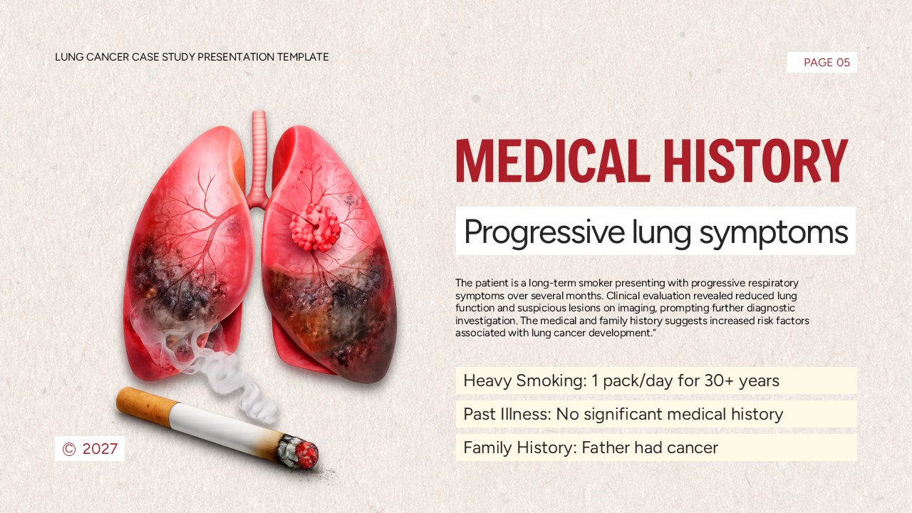 Lung Cancer Case Study Template - medical history slide with lung anatomy and smoking risk factors