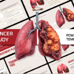 Lung Cancer Case Study Template - complete PowerPoint presentation overview with anatomical illustrations