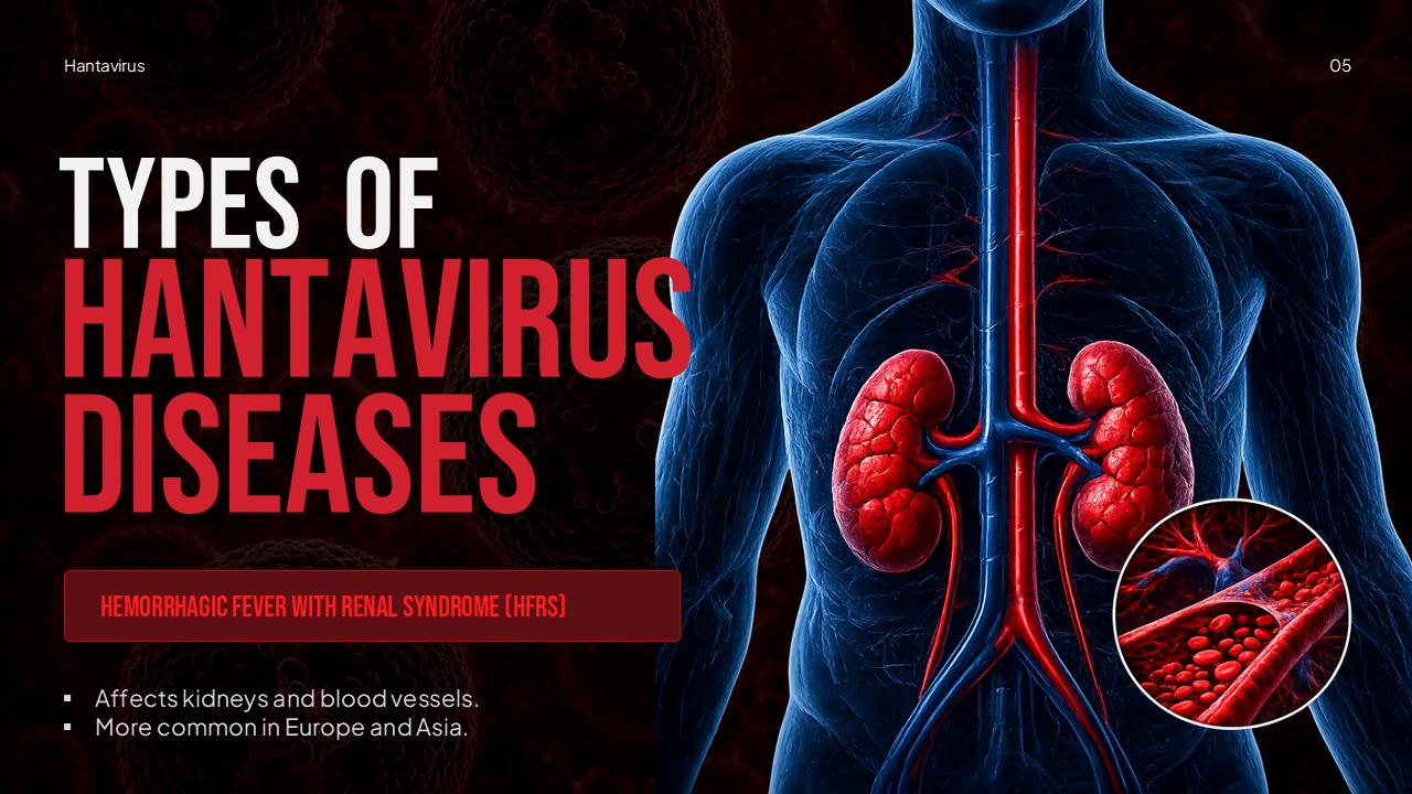 Hemorrhagic Fever Renal Syndrome slide with kidney anatomy illustration