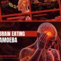 Brain Eating Amoeba Template - Cover slide to open science or public health presentations dramatically
