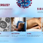 Measles Outbreak Template - disease education explainer slide