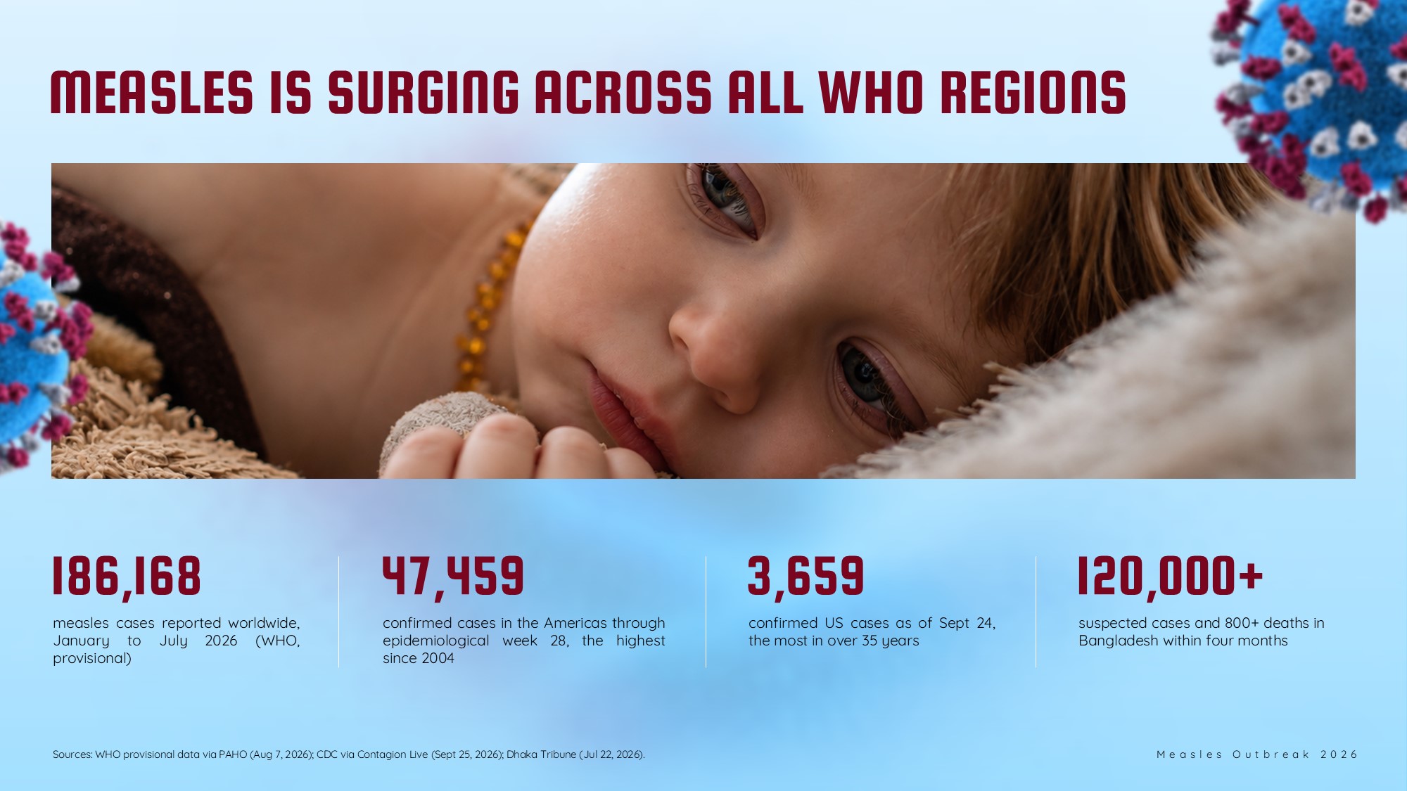 Measles Outbreak Template - global statistics KPI slide