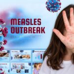 Measles Outbreak Template - deck preview collage