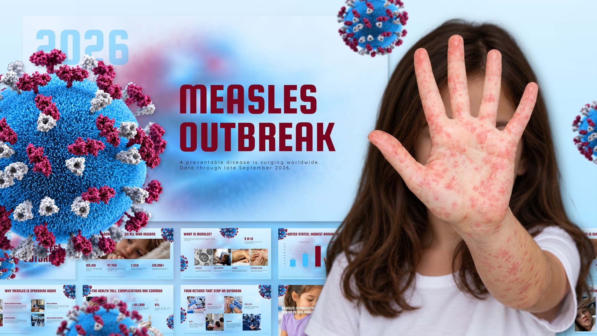 Measles Outbreak Template - deck preview collage