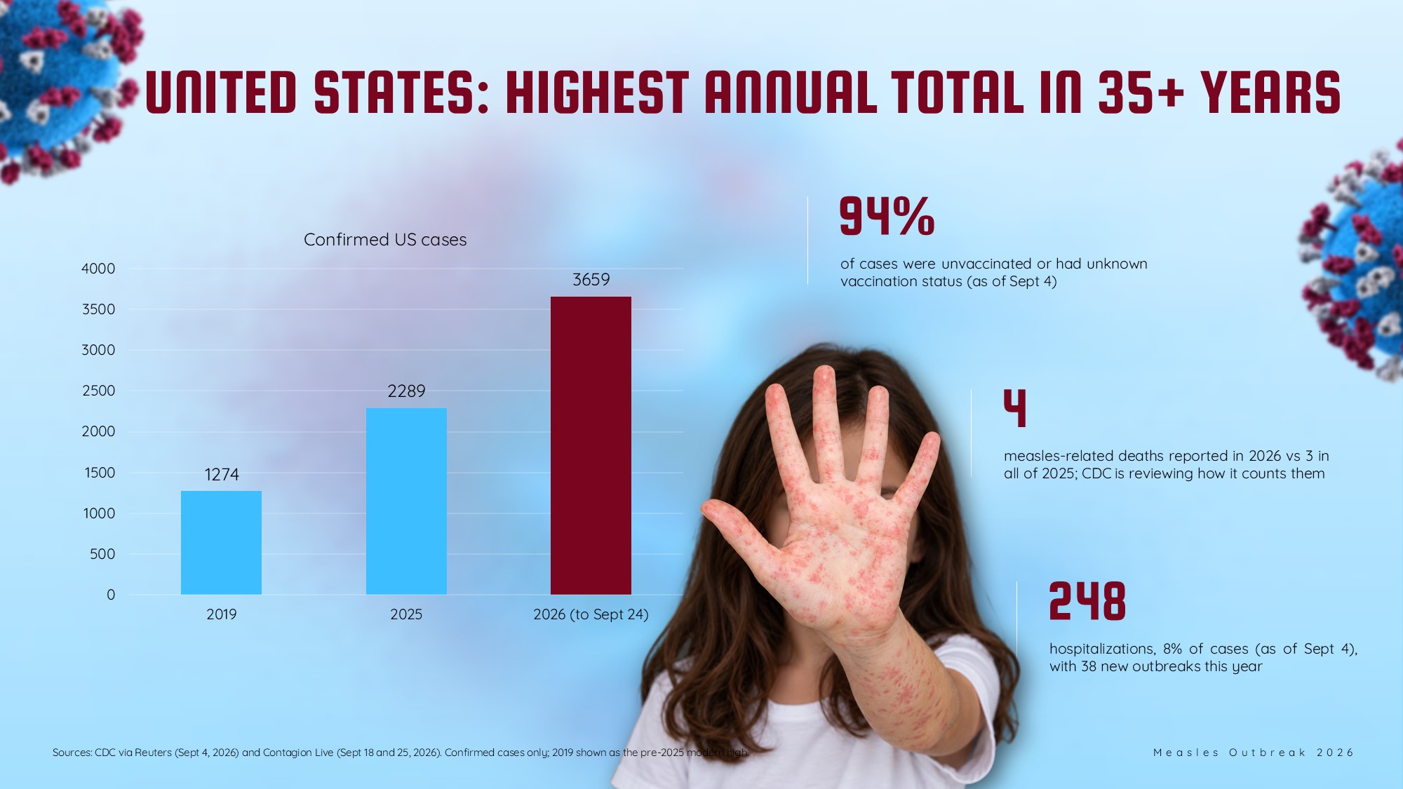 Measles Outbreak Template - US bar chart case data slide