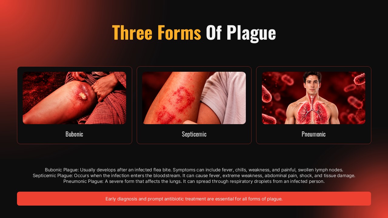 Plague Warning Russia - transmission pathways slide